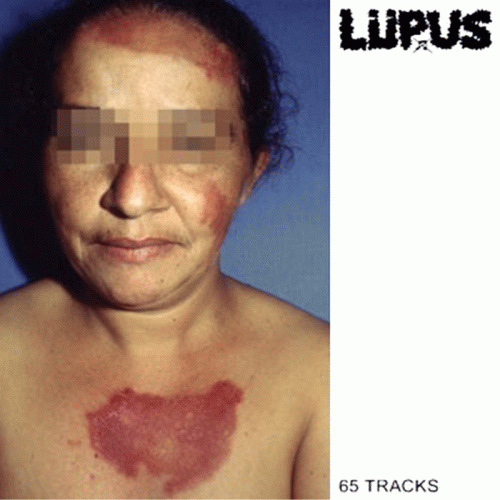 Lupus (BRA) : 65 Tracks